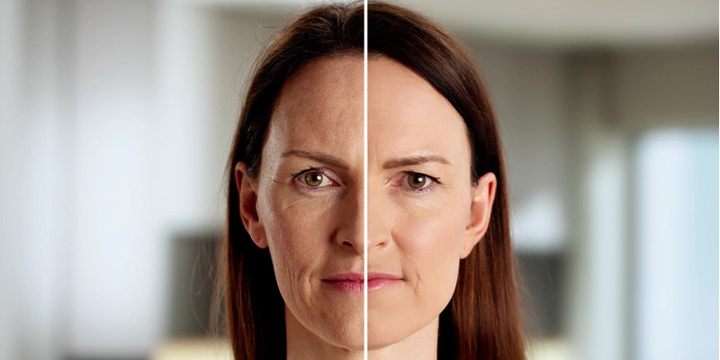   Zeichen der Hautalterung – wann zu Anti-Aging Produkten greifen?